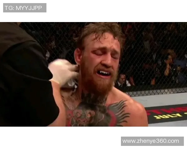 康纳与奥尔多的巅峰对决揭示了MMA赛场的荣耀与挑战